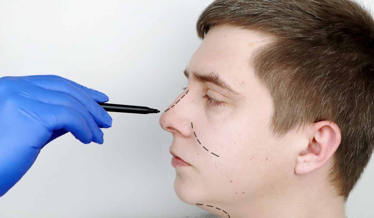 -عملية تجميل الانف