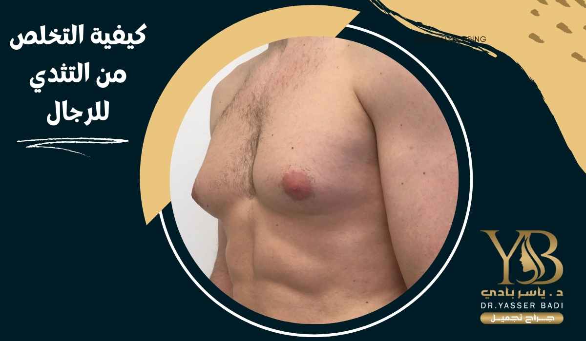 كيفية التخلص من التثدي للرجال