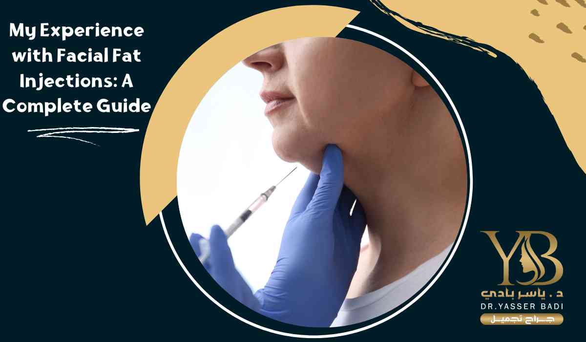 My Experience with Facial Fat Injections: A Complete Guide
