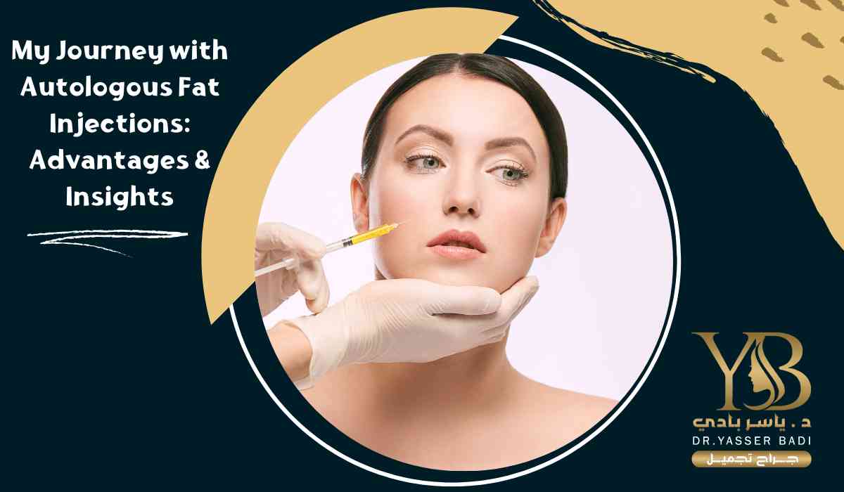 My Journey with Autologous Fat Injections: Advantages & Insights
