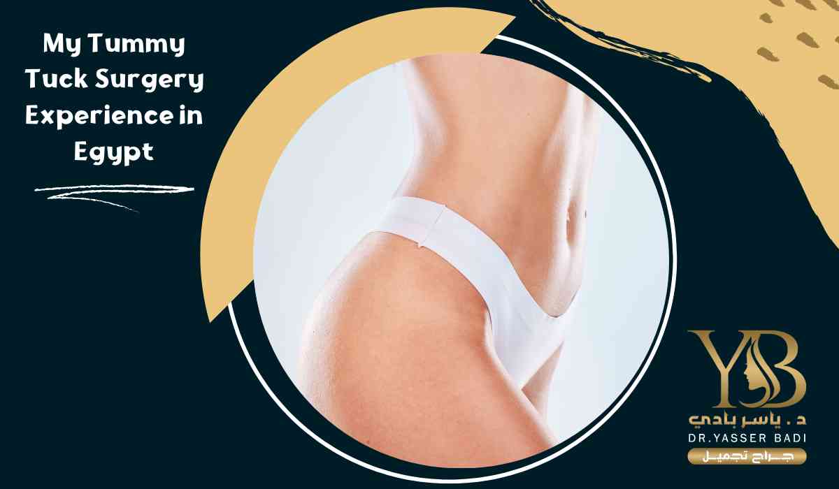 My Tummy Tuck Surgery Experience in Egypt