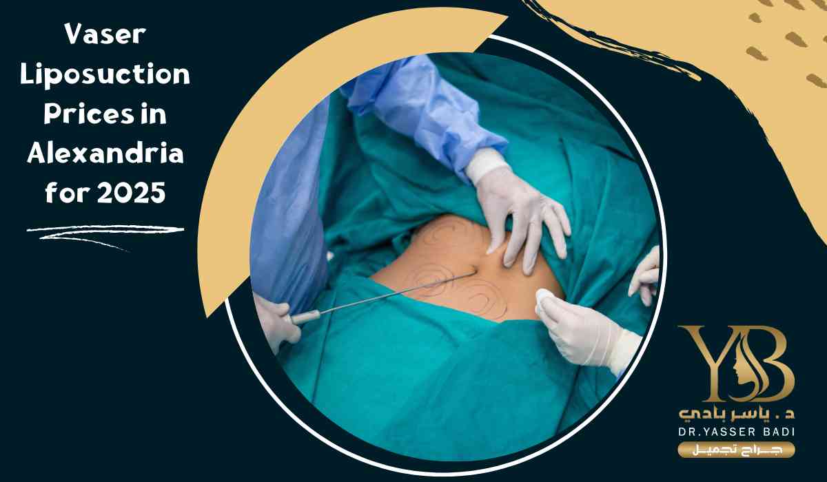 Vaser Liposuction Prices in Alexandria for 2025