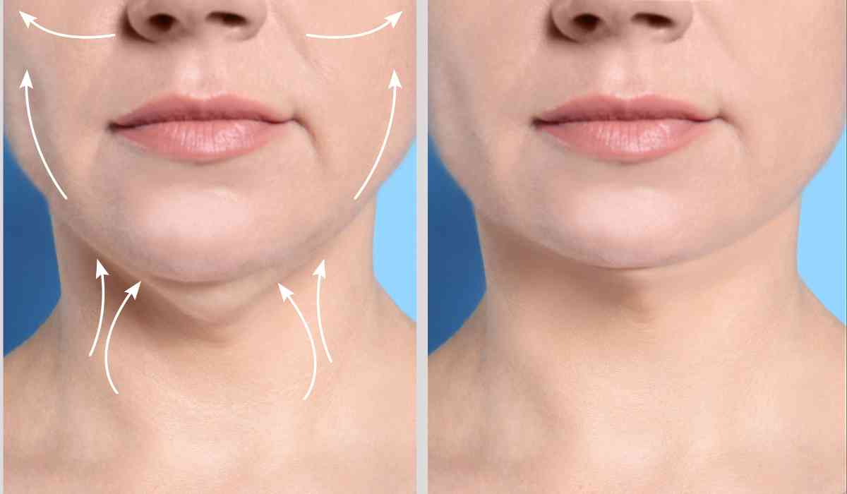 how-to-get-rid-of-double-chin-in-just-one-hour
