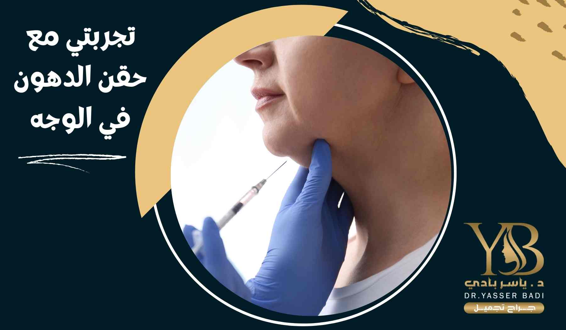 تجربتي مع حقن الدهون في الوجه