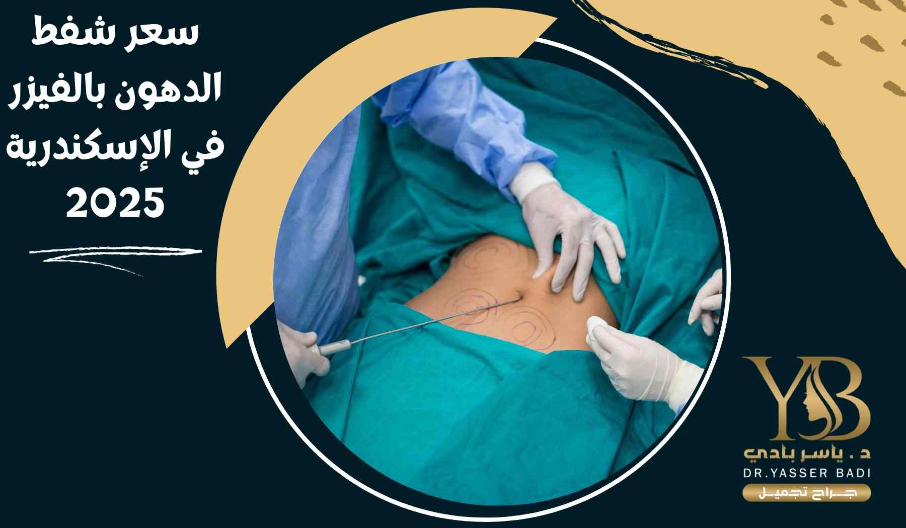 سعر شفط الدهون بالفيزر في الإسكندرية 2025