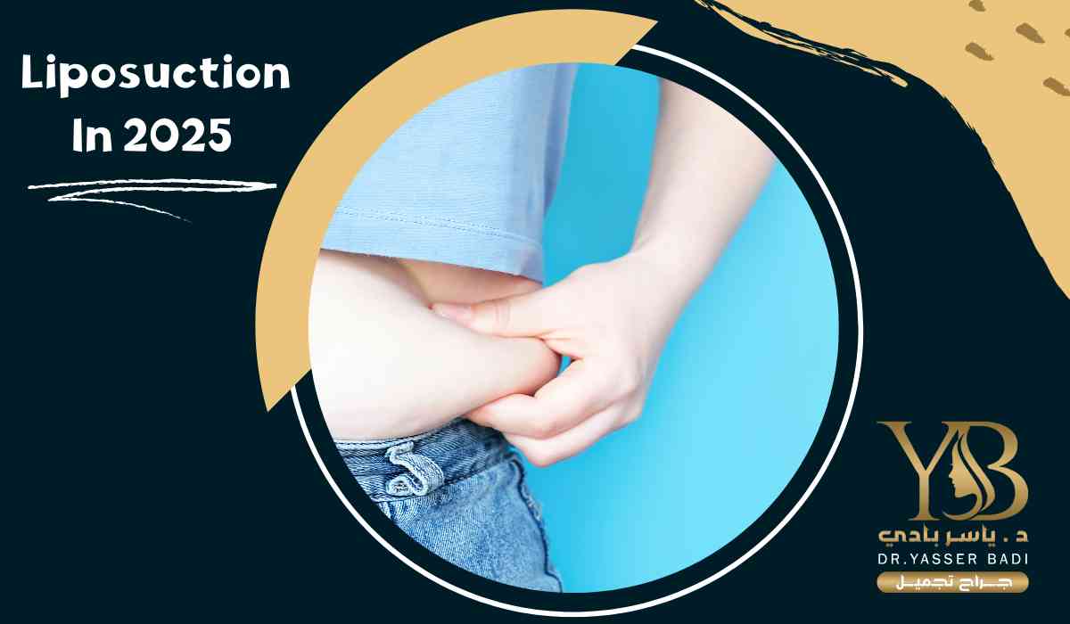 Liposuction in 2025