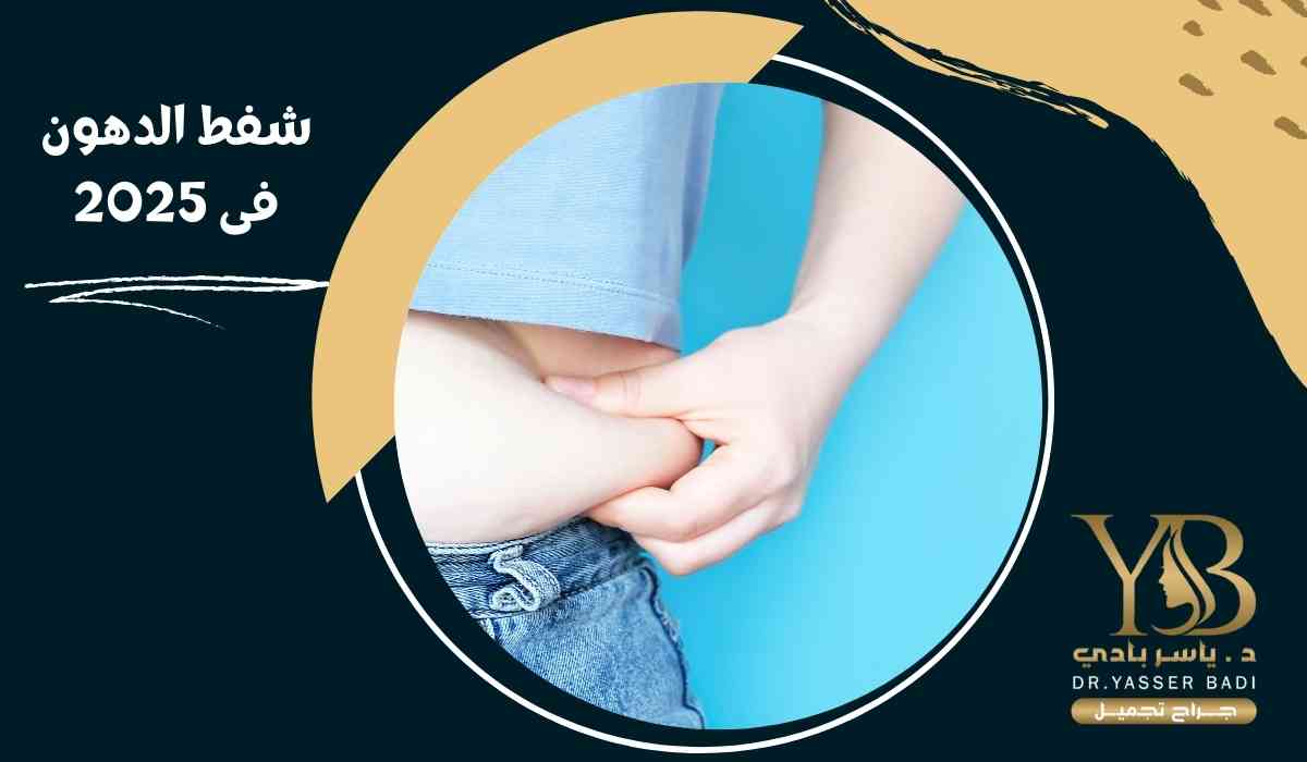 شفط الدهون فى 2025