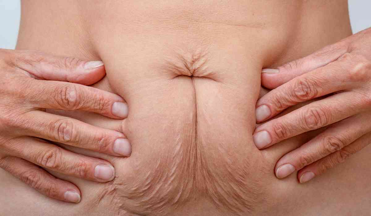 عمليات-مامي-ميك-اوفر