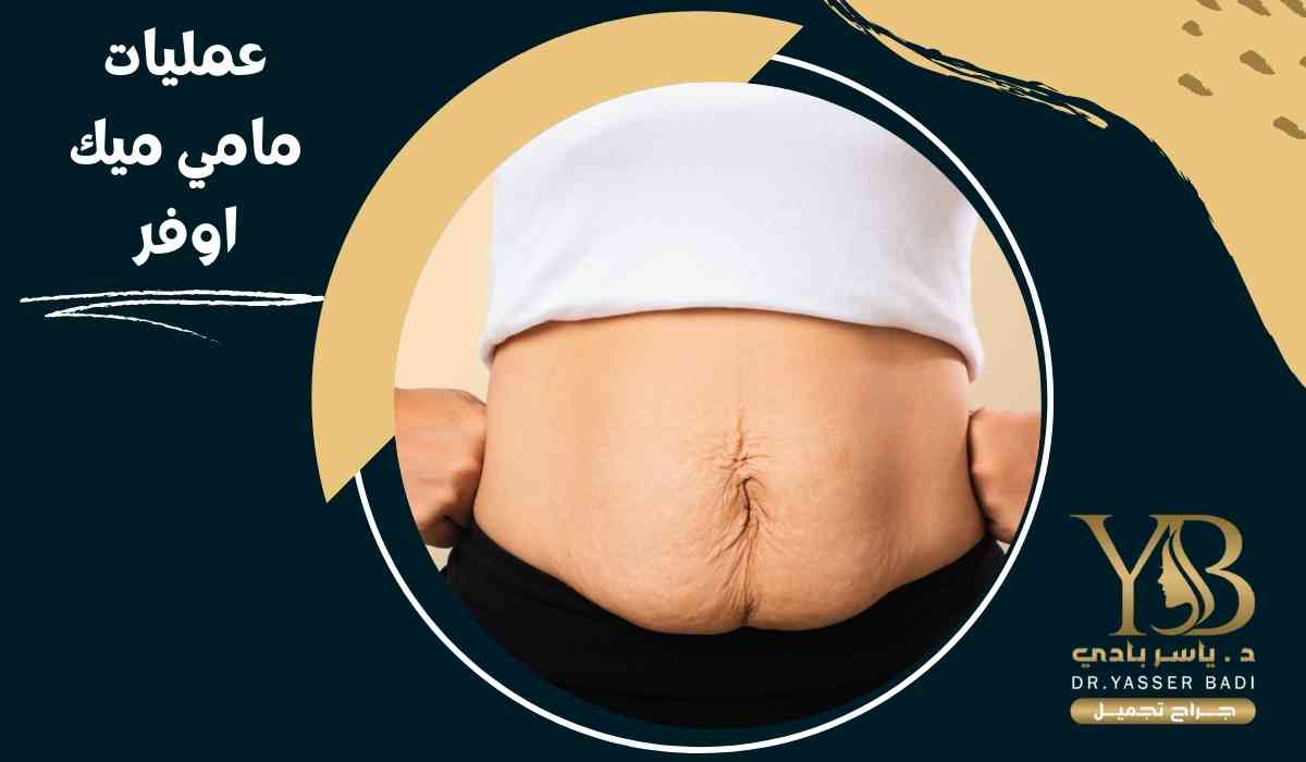 عمليات-مامي-ميك-اوفر عمليات-مامي-ميك-اوفر