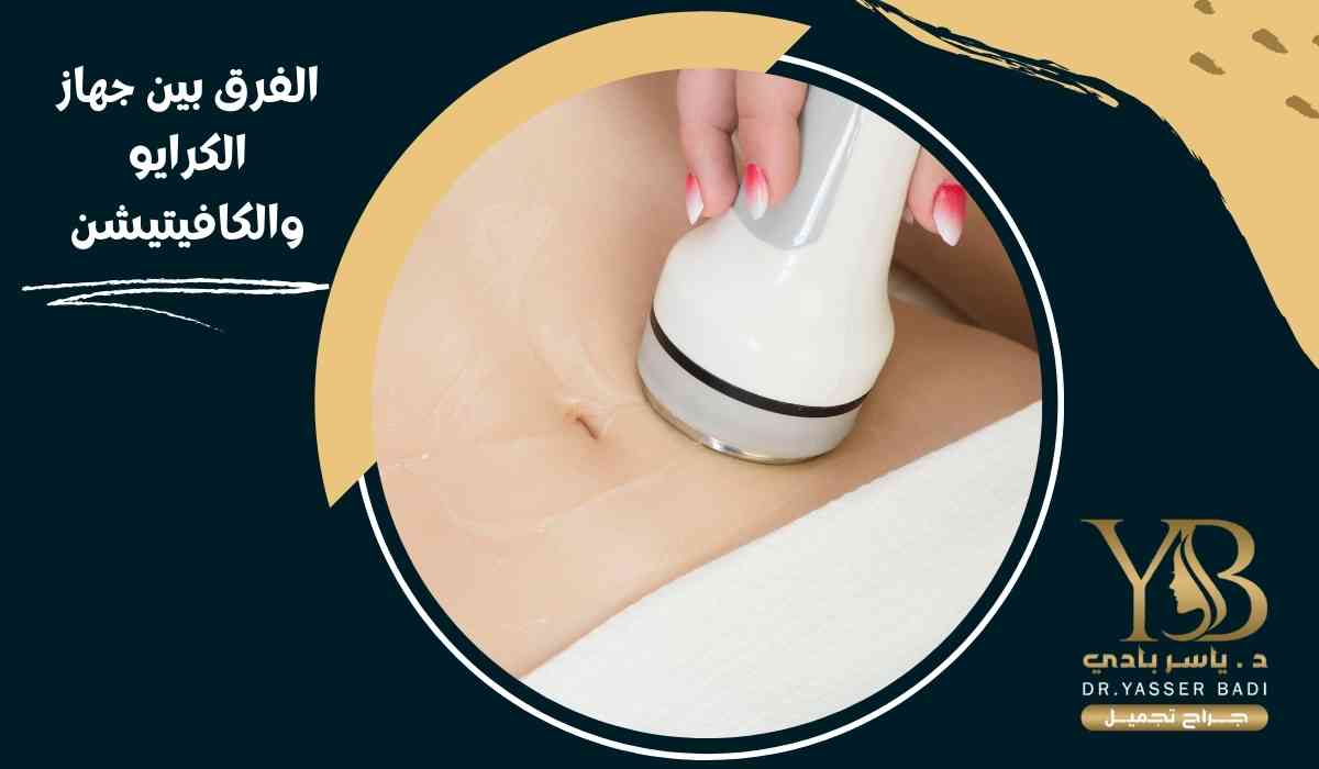 الفرق بين جهاز الكرايو والكافيتيشن