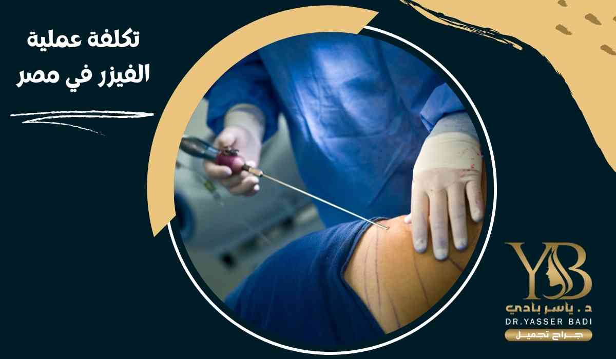 تكلفة عملية الفيزر في مصر