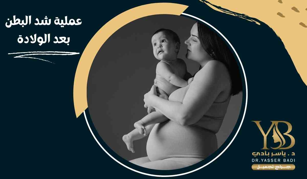 عملية-شد-البطن-بعد-الولادة