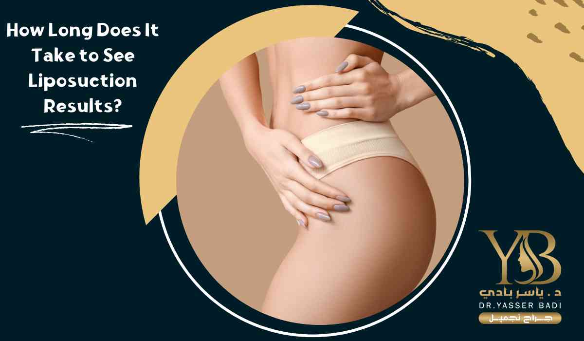 How Long Does It Take to See Liposuction Results?