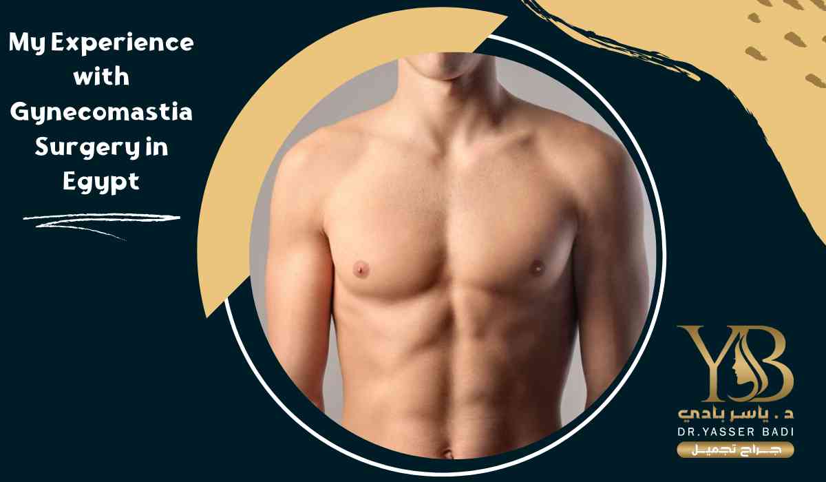 My Experience with Gynecomastia Surgery in Egypt