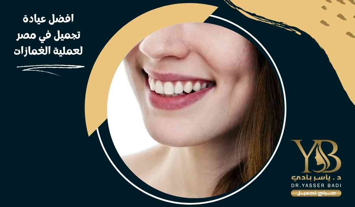 افضل عيادة تجميل في مصر لعملية الغمازات