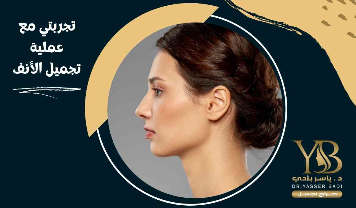 تجربتي مع عملية تجميل الأنف