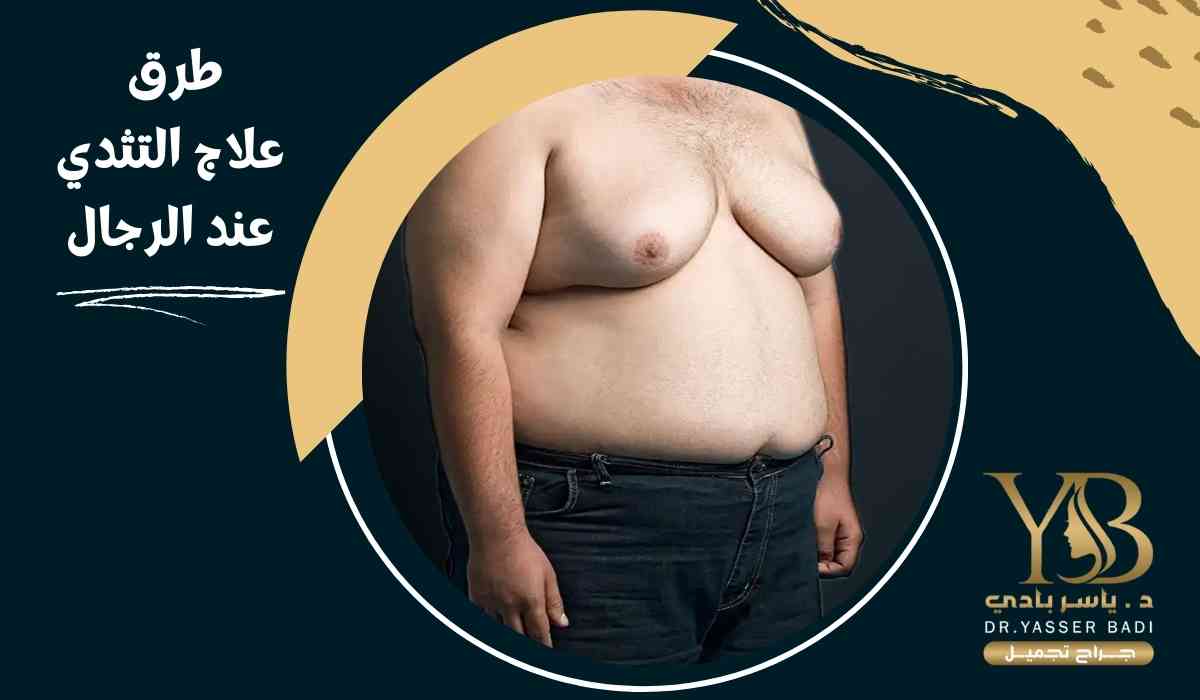 طرق علاج التثدي عند الرجال