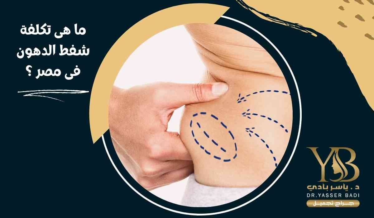 ما هى تكلفة شفط الدهون فى مصر؟