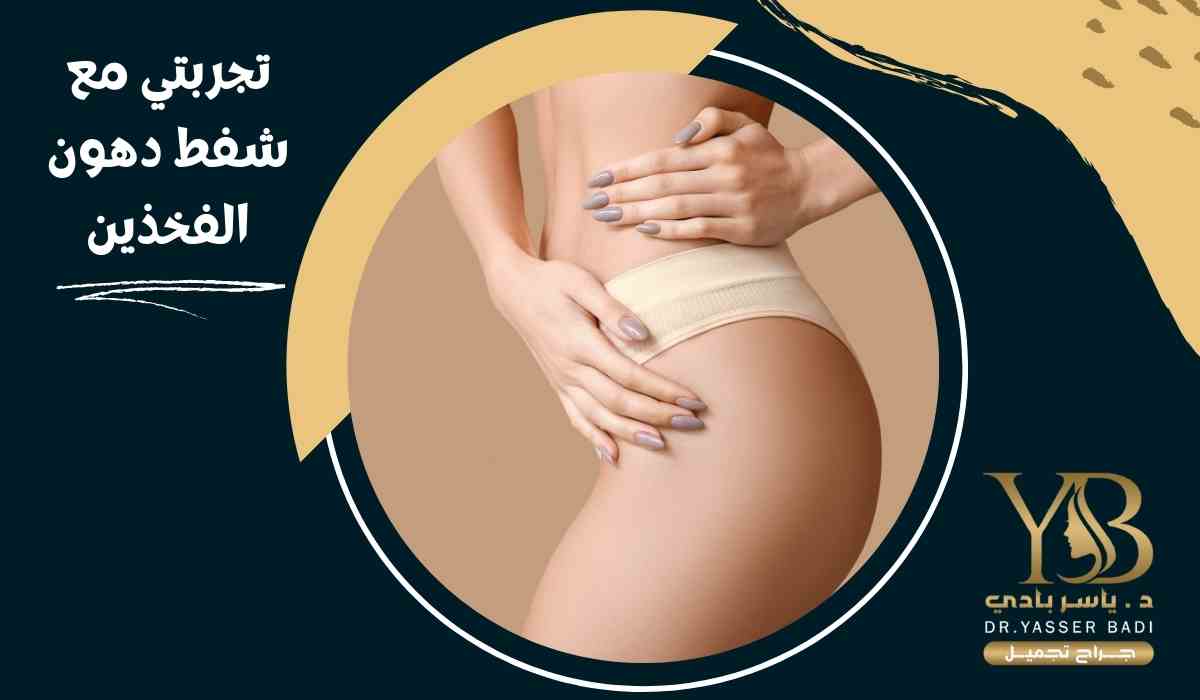تجربتي مع شفط دهون الفخذين
