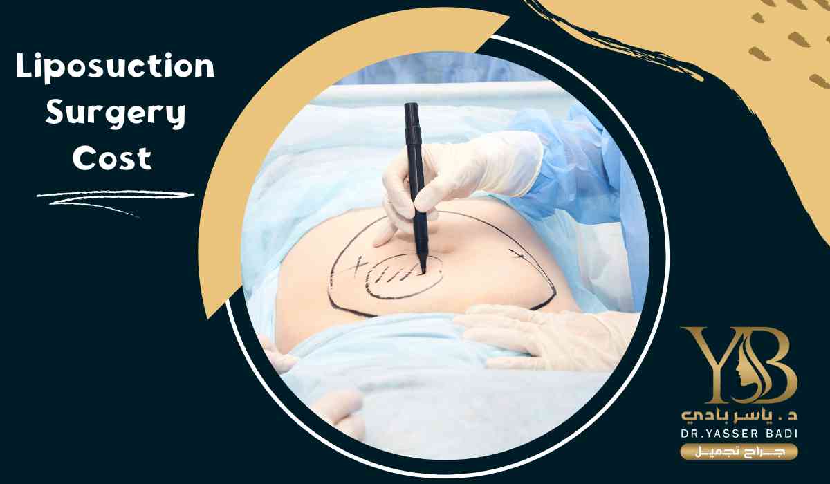 liposuction surgery cost