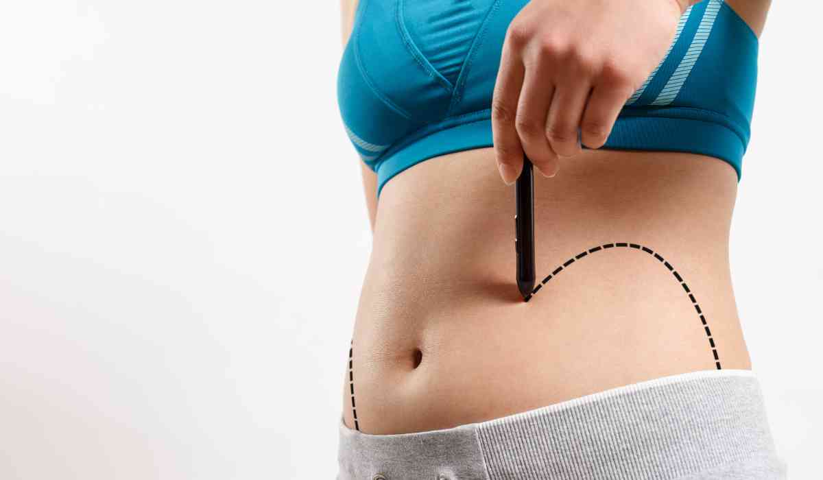 Stomach-Liposuction-Surgery