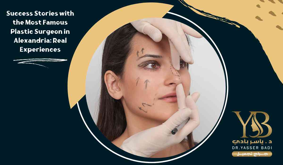 Success Stories with the Most Famous Plastic Surgeon in Alexandria: Real Experiences