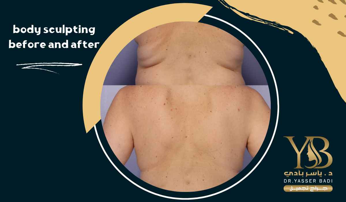 Body sculpting before and after