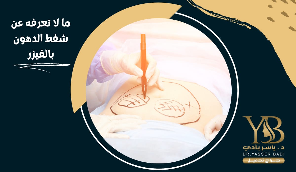 ما لا تعرفه عن شفط الدهون بالفيزر