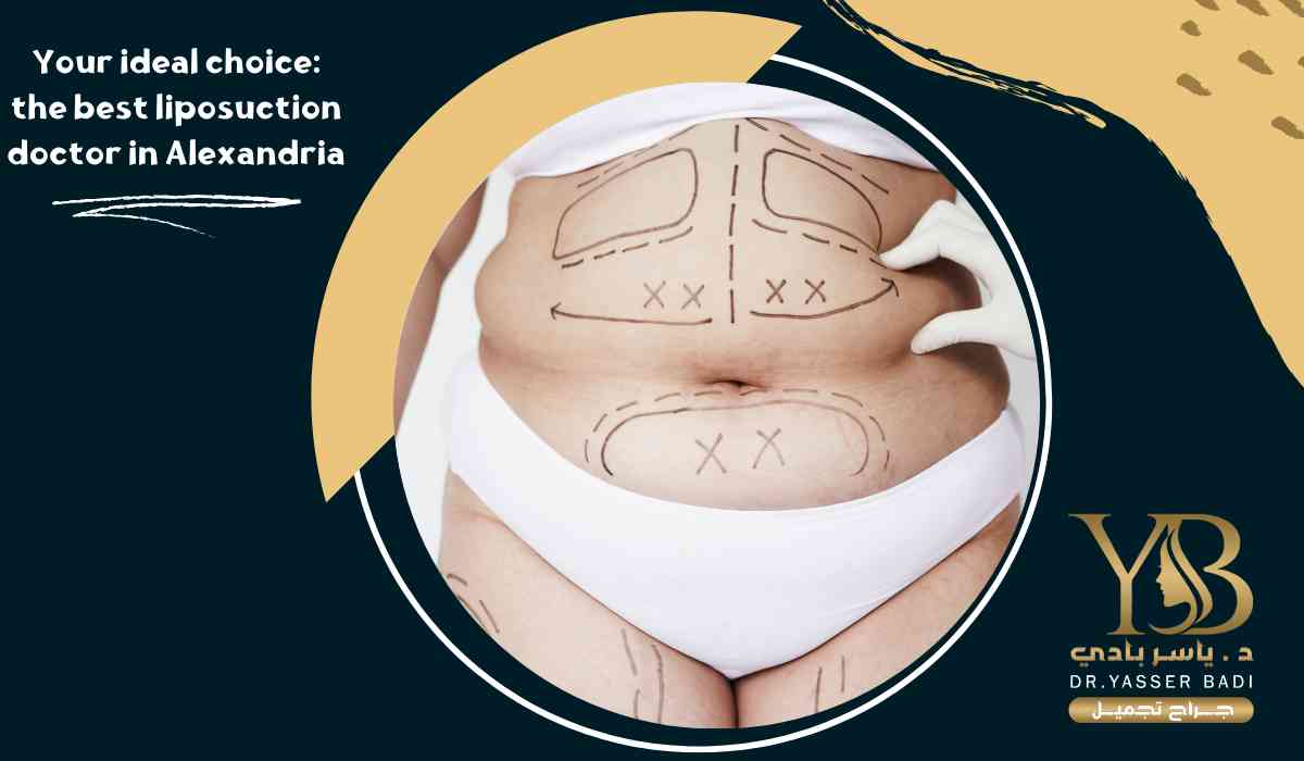 Your ideal choice: the best liposuction doctor in Alexandria