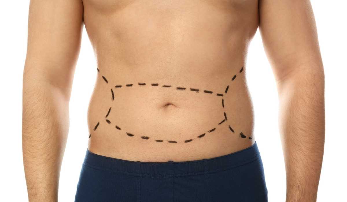 احسن-جراح-تجميل-لعملية-شد-البطن
