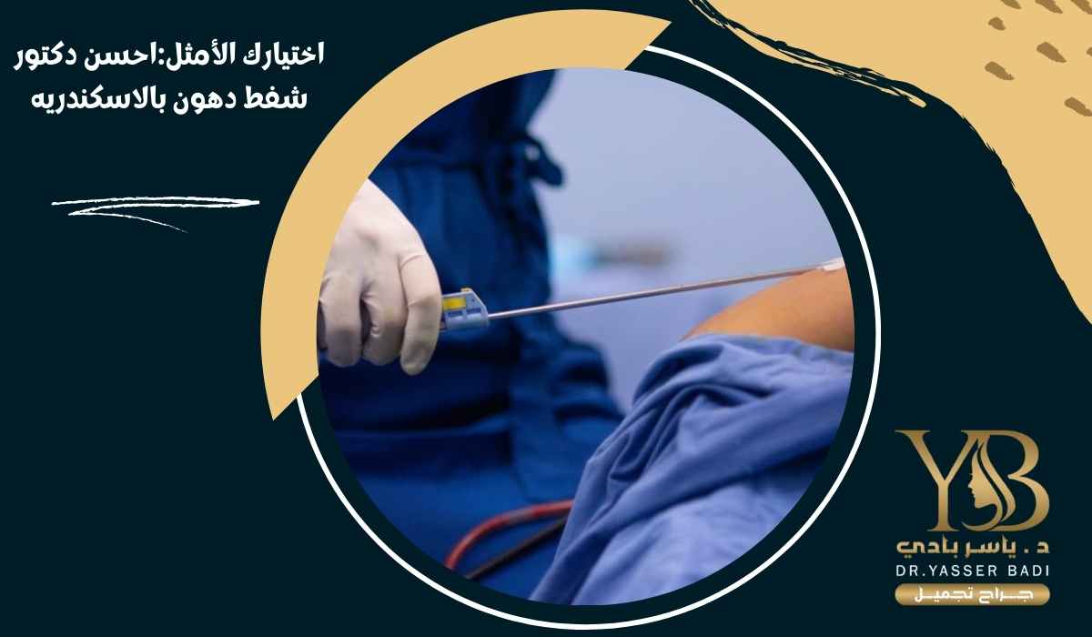 اختيارك الأمثل: احسن دكتور شفط دهون بالاسكندرية