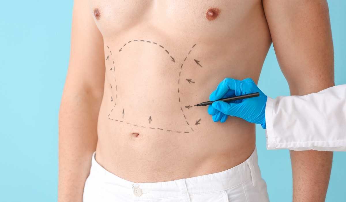 اشهر-دكتور-تجميل-لعملية-نحت-الجسم