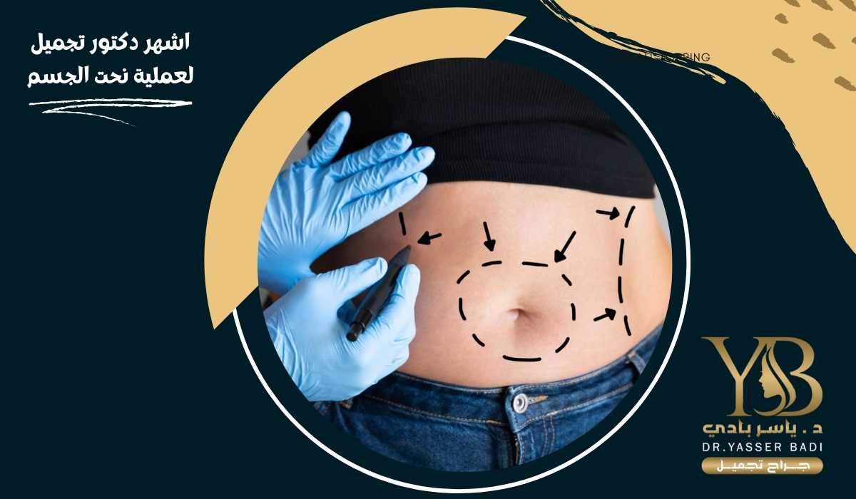اشهر دكتور تجميل لعملية نحت الجسم