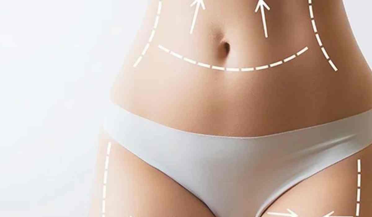 أفضل-دكتور-شفط-دهون-بالفيزر-في-مصر