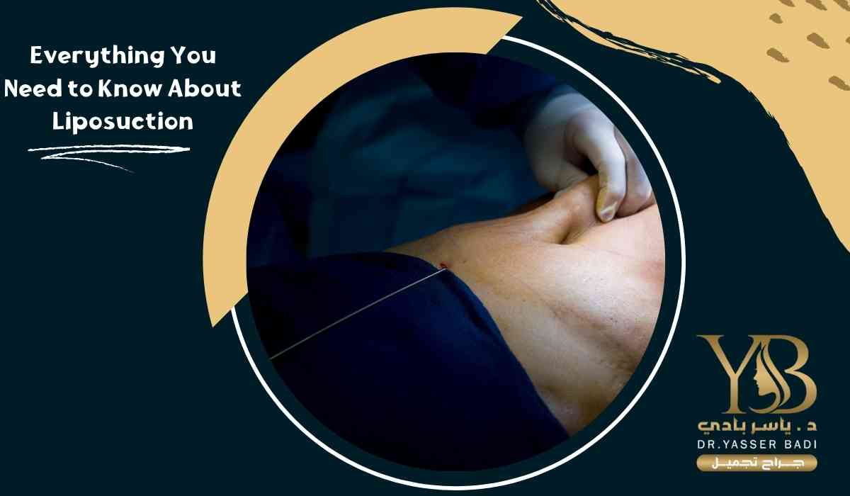 Everything You Need to Know About Liposuction