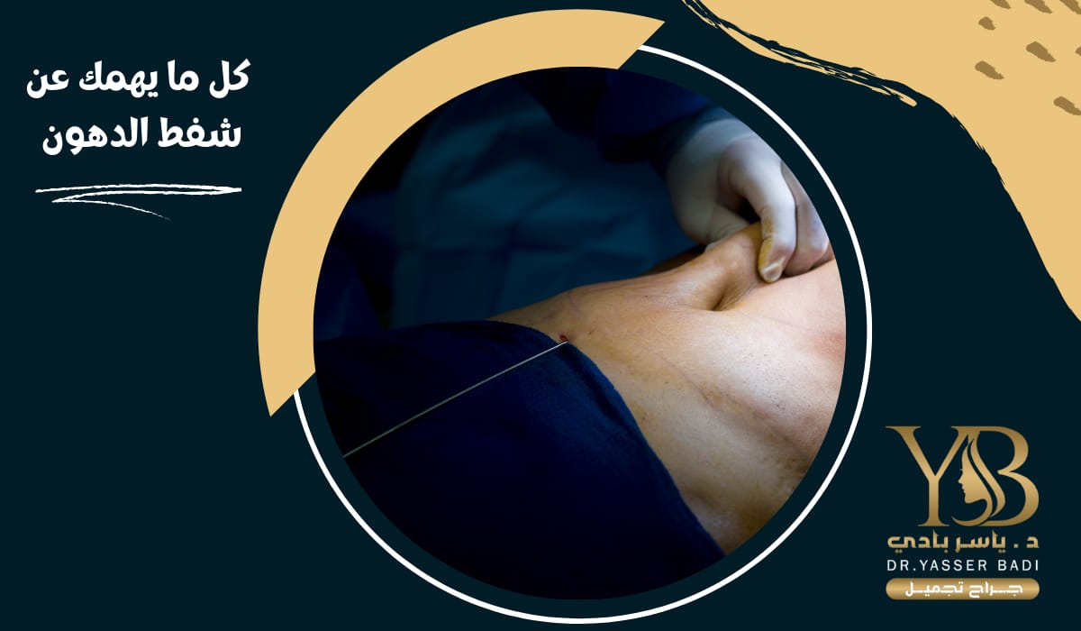كل ما يهمك عن شفط الدهون