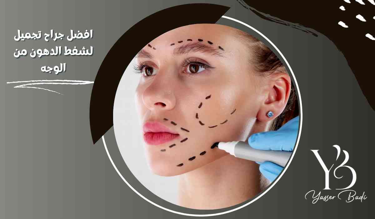 افضل جراح تجميل لشفط الدهون من الوجه