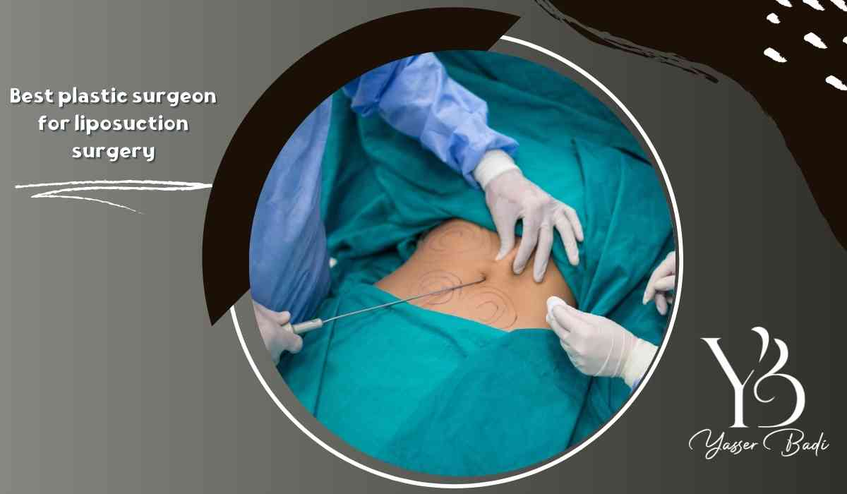 Best plastic surgeon for liposuction surgery