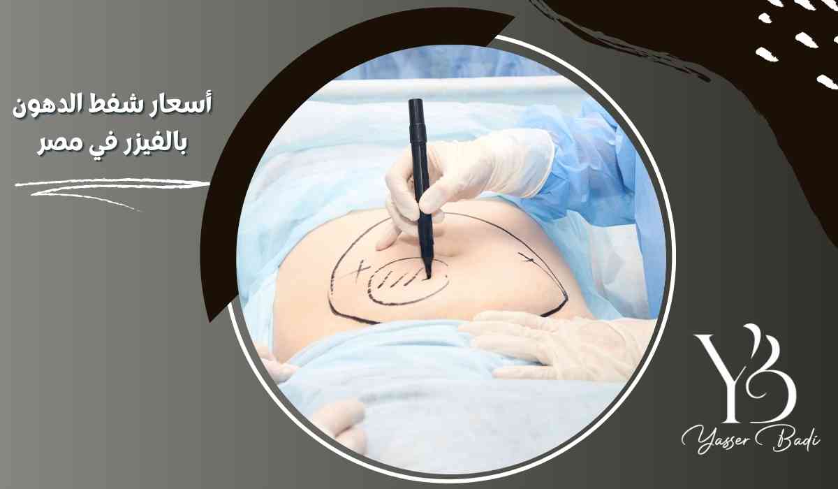 أسعار شفط الدهون بالفيزر في مصر