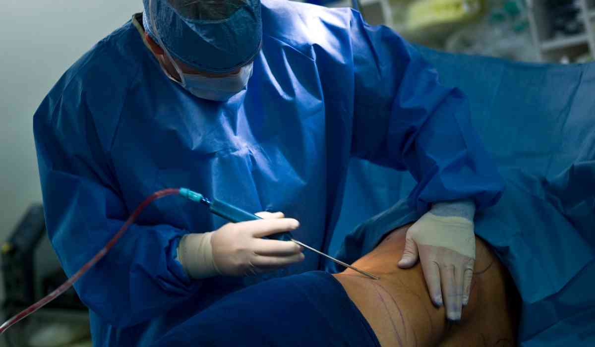 اشهر-دكتور-تجميل-لشفط-الدهون