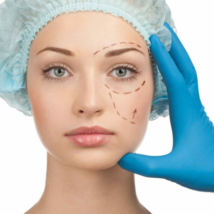 Beautiful young woman with perforation lines on her face before plastic surgery operation. Beautician touching woman face.